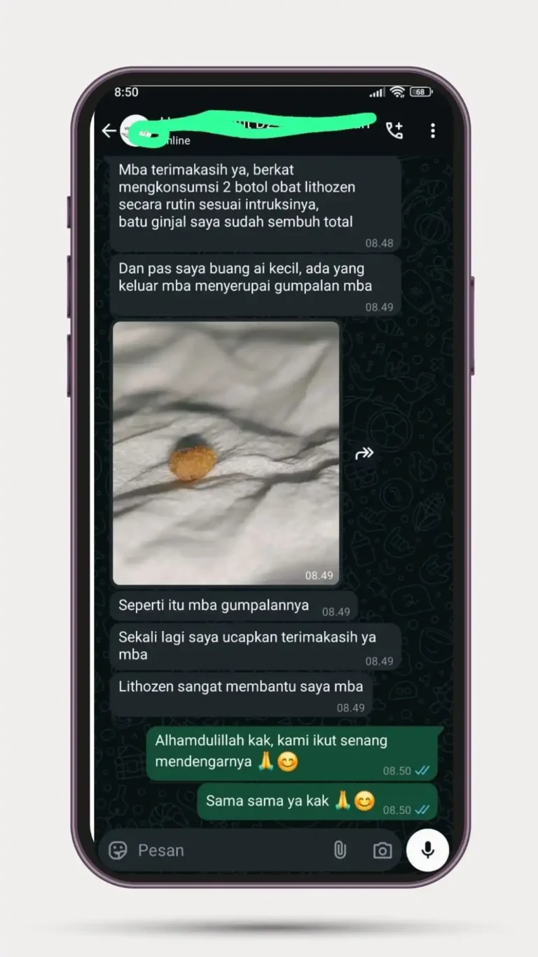 testi-batu-ginjal-7-2.webp